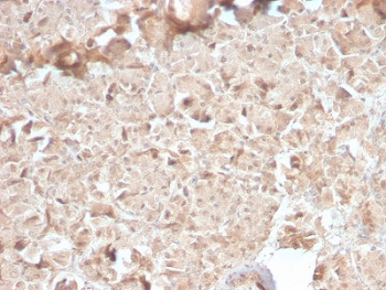 Recombinant CELA3B Antibody / Elastase 3B