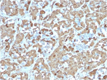 Recombinant GH Antibody (pituitary) / Growth Hormone