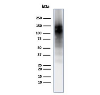 CD56 Antibody