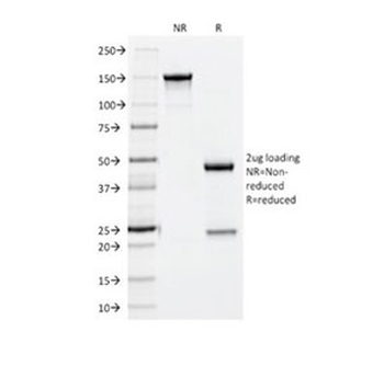 CD56 Antibody