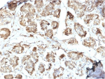 NME2 Antibody / NM23-H2