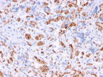 Recombinant Spectrin alpha 1 Antibody / SPTA1