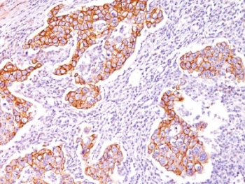 p-Tyr Antibody / Phosphotyrosine
