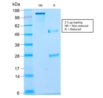 Nuclear Antigen Antibody