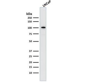 Folate Hydrolase 1 Antibody / FOLH1 / PSMA