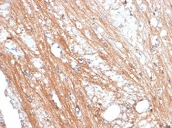 Folate Hydrolase 1 Antibody / FOLH1 / PSMA