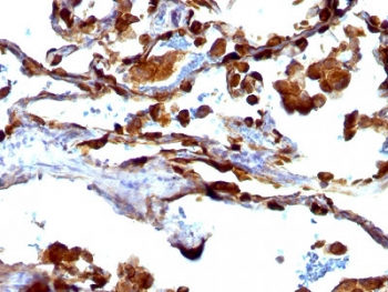 MUC1 Antibody / Mucin-1