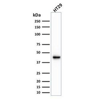 Cytokeratin 20 Antibody / CK20
