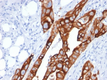 Cytokeratin 20 Antibody / CK20 / KRT20