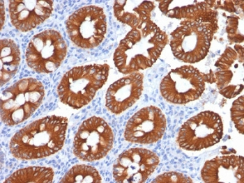 Cytokeratin 20 Antibody / CK20 / KRT20