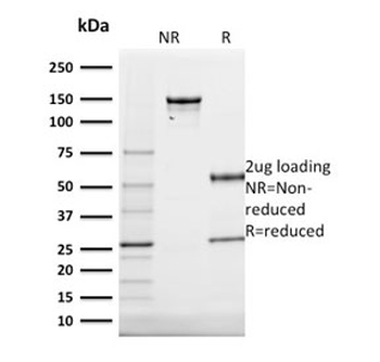 Cytokeratin 20 Antibody / CK20 / KRT20