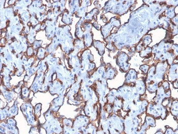 Recombinant CD31 Antibody / PECAM-1