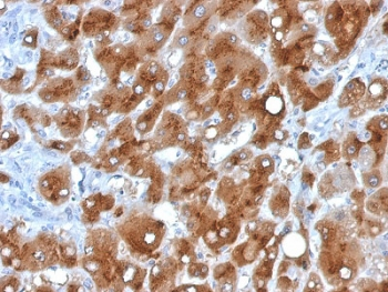 Serum Amyloid A Antibody / SAA1 + SAA2