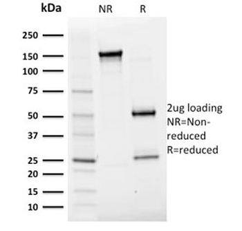 Albumin Antibody / Serum Albumin