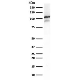 ACTN2 Antibody / Sarcomeric Alpha Actinin / Alpha Actinin 2
