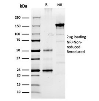 Prolactin Antibody / PRL