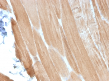 ACTN2 Antibody / Alpha Actinin 2 / Sarcomeric Alpha Actinin