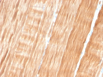 ACTN2 Antibody / Alpha Actinin 2 / Sarcomeric Alpha Actinin