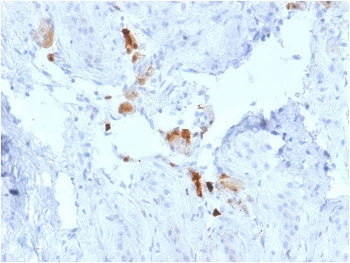 Calbindin 2 Antibody / CALB2 / Calretinin