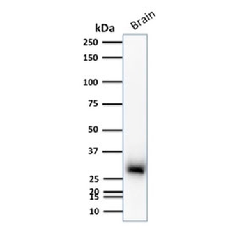 Calbindin 2 Antibody / CALB2 / Calretinin