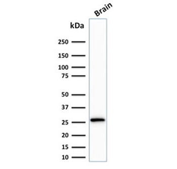 Calbindin 2 Antibody / CALB2 / Calretinin
