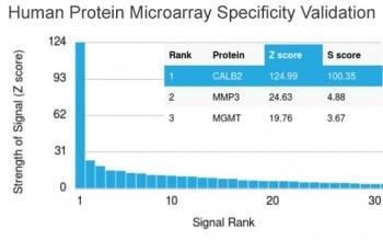 Calbindin 2 Antibody / CALB2 / Calretinin