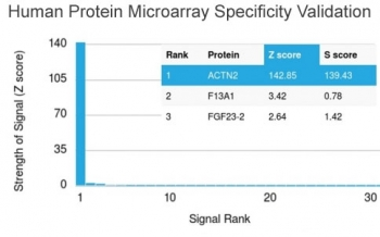 ACTN2 Antibody / Alpha Actinin 2 / Sarcomeric Alpha Actinin
