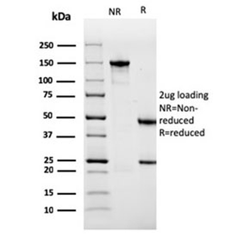 ACTN2 Antibody / Alpha Actinin 2 / Sarcomeric Alpha Actinin