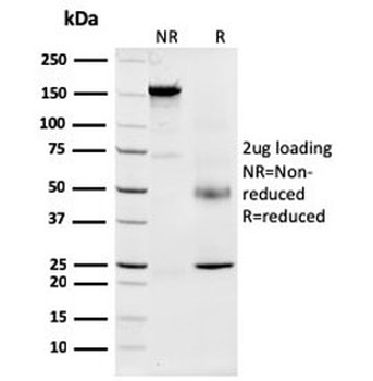 Nucleophosmin Antibody / NPM1