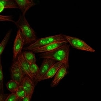 Nucleophosmin Antibody / NPM1