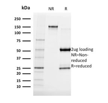 Albumin Antibody / Serum Albumin