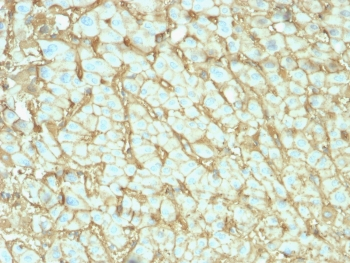 Albumin Antibody / Serum Albumin