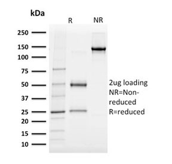 Albumin Antibody / Serum Albumin
