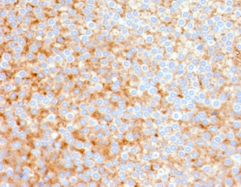 SERBP1 Antibody / PAI-RBP1