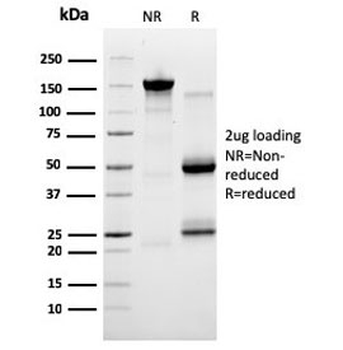 SERBP1 Antibody / PAI-RBP1