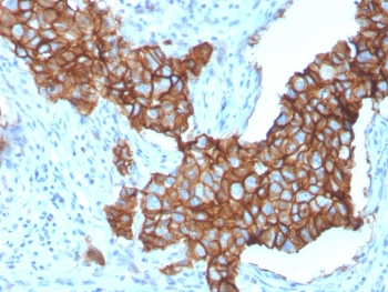 HER-2 Antibody / ErbB2