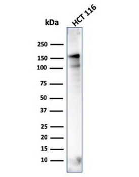 MSH6 Antibody