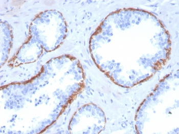 Cytokeratin 5 Antibody / KRT5