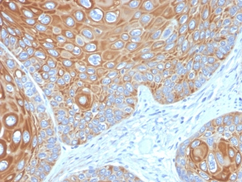 Cytokeratin 5 Antibody / KRT5