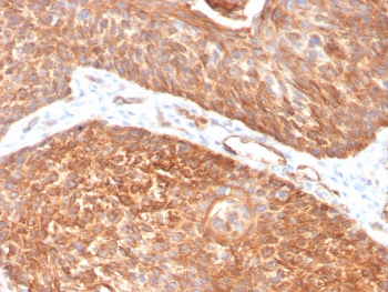Cytokeratin 5 Antibody / KRT5