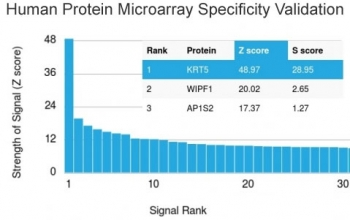 Cytokeratin 5 Antibody / KRT5