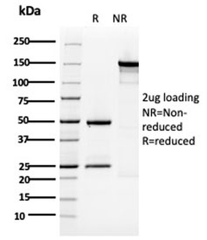 Cytokeratin 5 Antibody / KRT5 / CK5