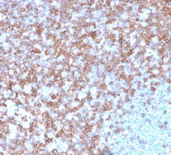 CD43 Antibody
