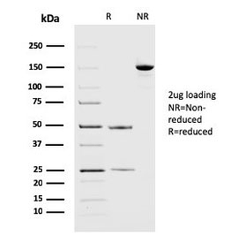 PD-L2 Antibody / Programmed death ligand 2 / CD273