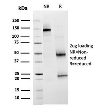 TIM3 Antibody / HAVCR2