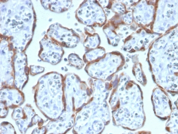 PAPPA Antibody / Pappalysin-1