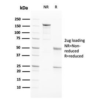 PAPPA Antibody / Pappalysin-1