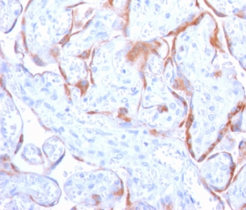 PAPP-A Antibody / Pappalysin-1