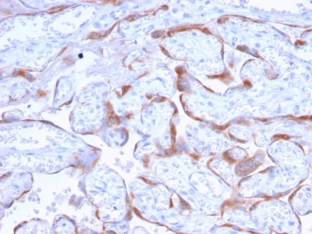 PAPP-A Antibody / Pappalysin-1