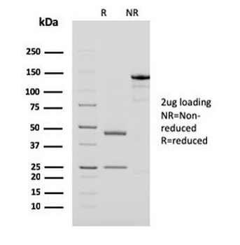 PAPP-A Antibody / Pappalysin-1